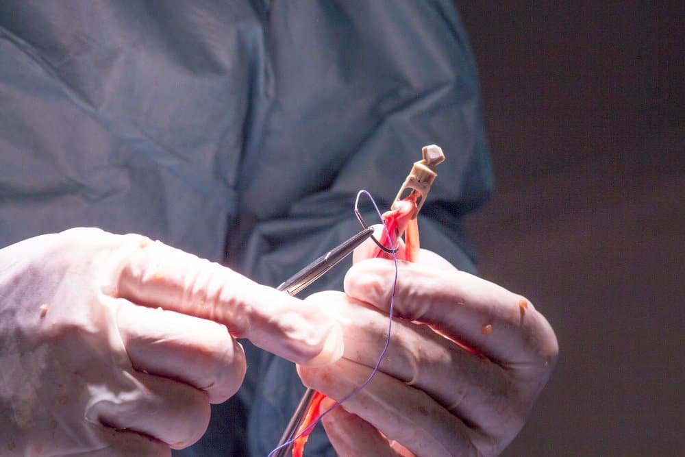 قسطرة الرحم في السعودية: حل طبي متقدم بدون جراحة