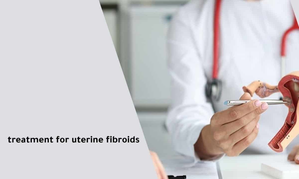 Treatment for uterine fibroids: What You Need to Know?