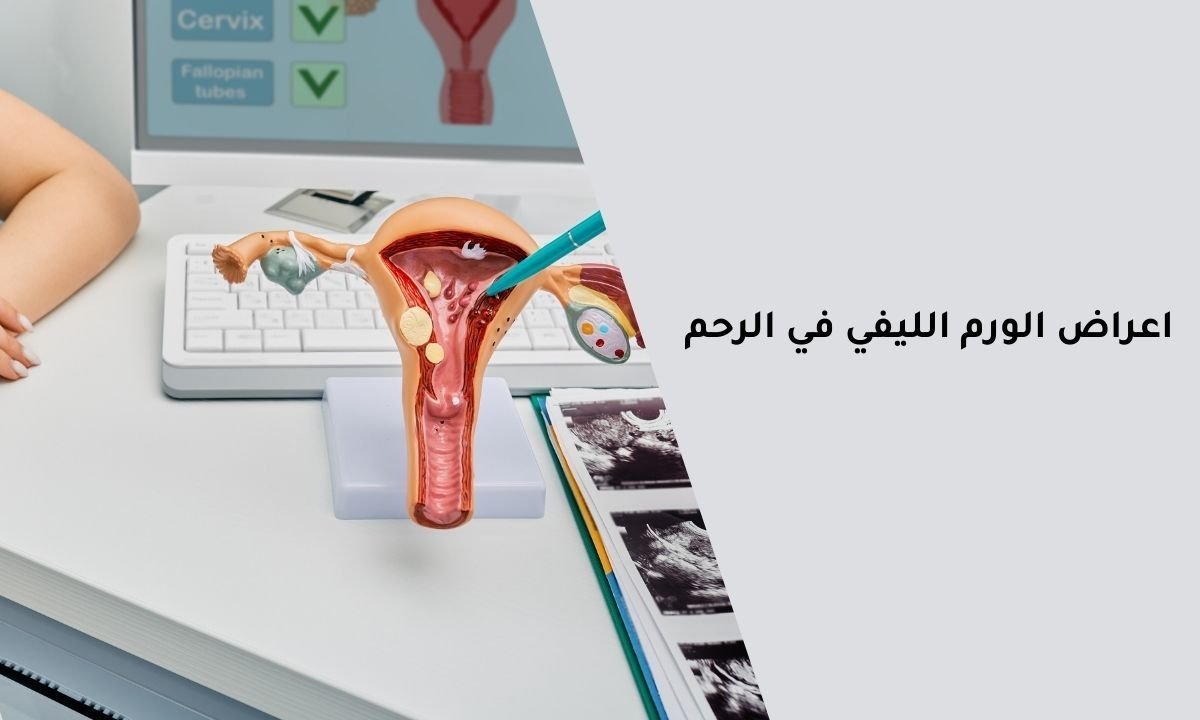 اعراض الورم الليفي في الرحم: ما هي؟