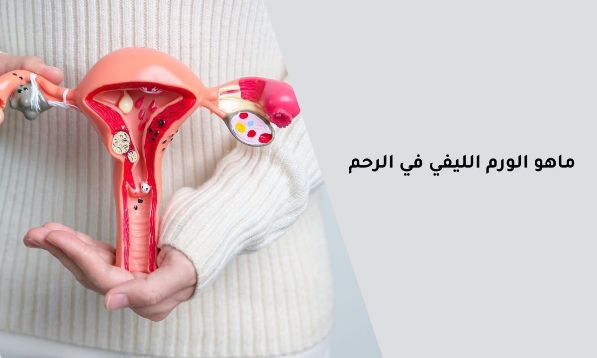 ماهو الورم الليفي في الرحم؟ اجابة على كل الأسئلة