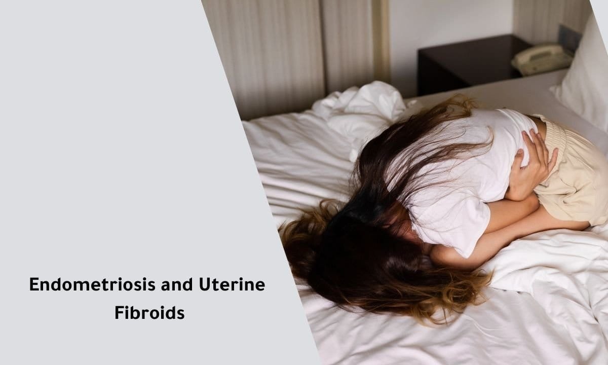 Understanding Endometriosis and Uterine Fibroids