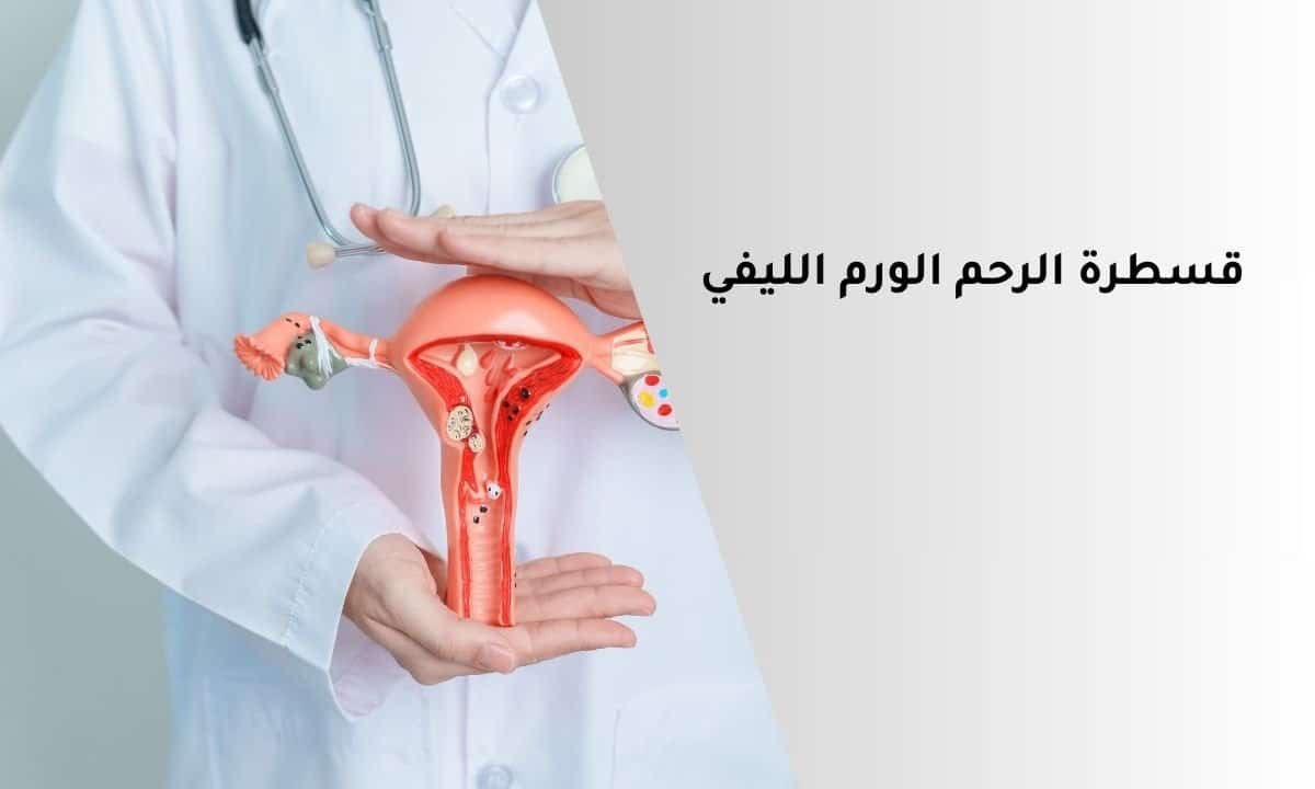 قسطرة الرحم الورم الليفي مع د. سمير عبد الغفار