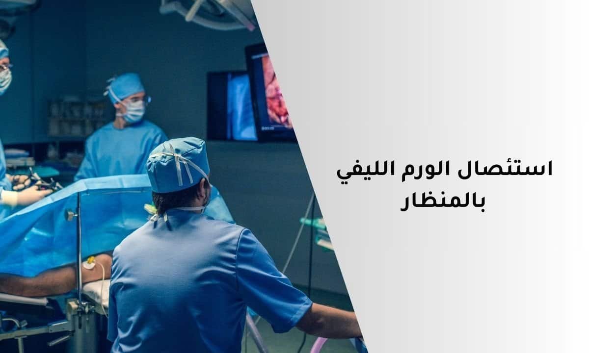 استئصال الورم الليفي بالمنظار: هل هو العلاج المثالي؟