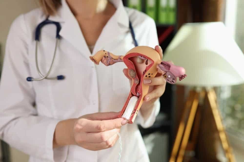 هل قسطرة الرحم مؤلمة؟ | علاج الأورام الليفية بدون جراحة