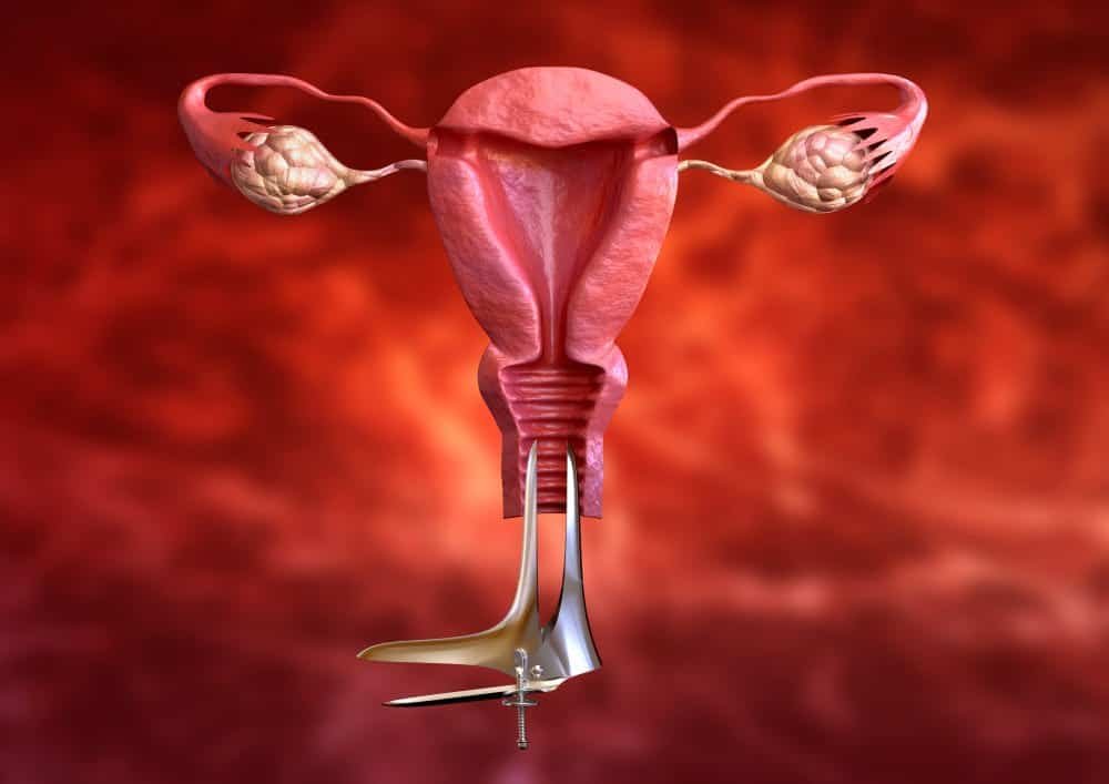 Uterine Fibroid Embolization Side Effects: What to Really Expect