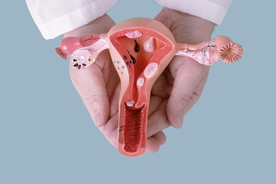 which size of fibroid is normal