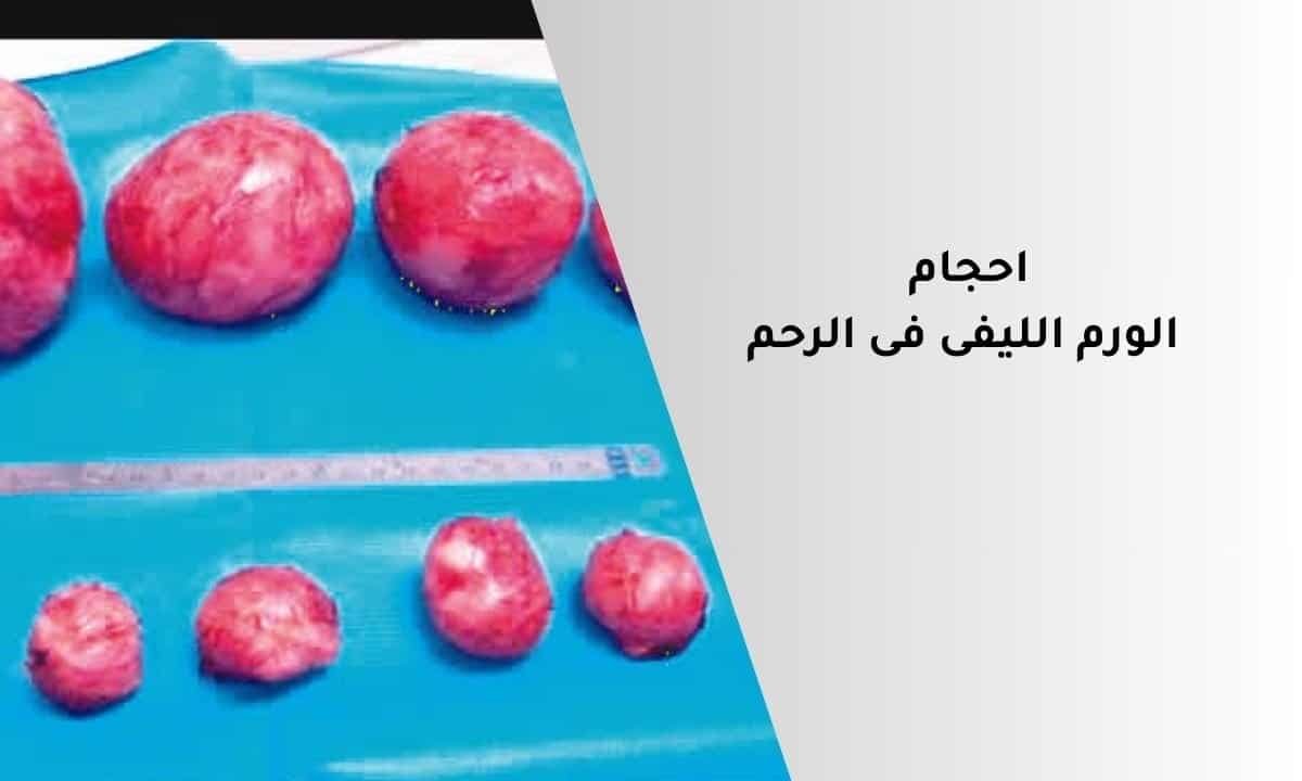 احجام الورم الليفى فى الرحم