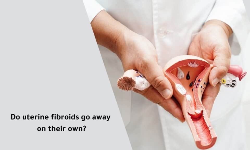 Do Uterine Fibroids Go Away On Their Own