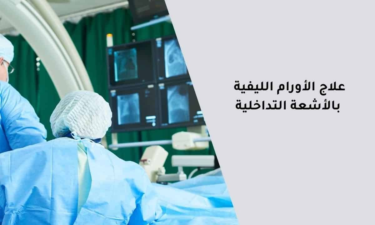 علاج الأورام الليفية بالأشعة التداخلية