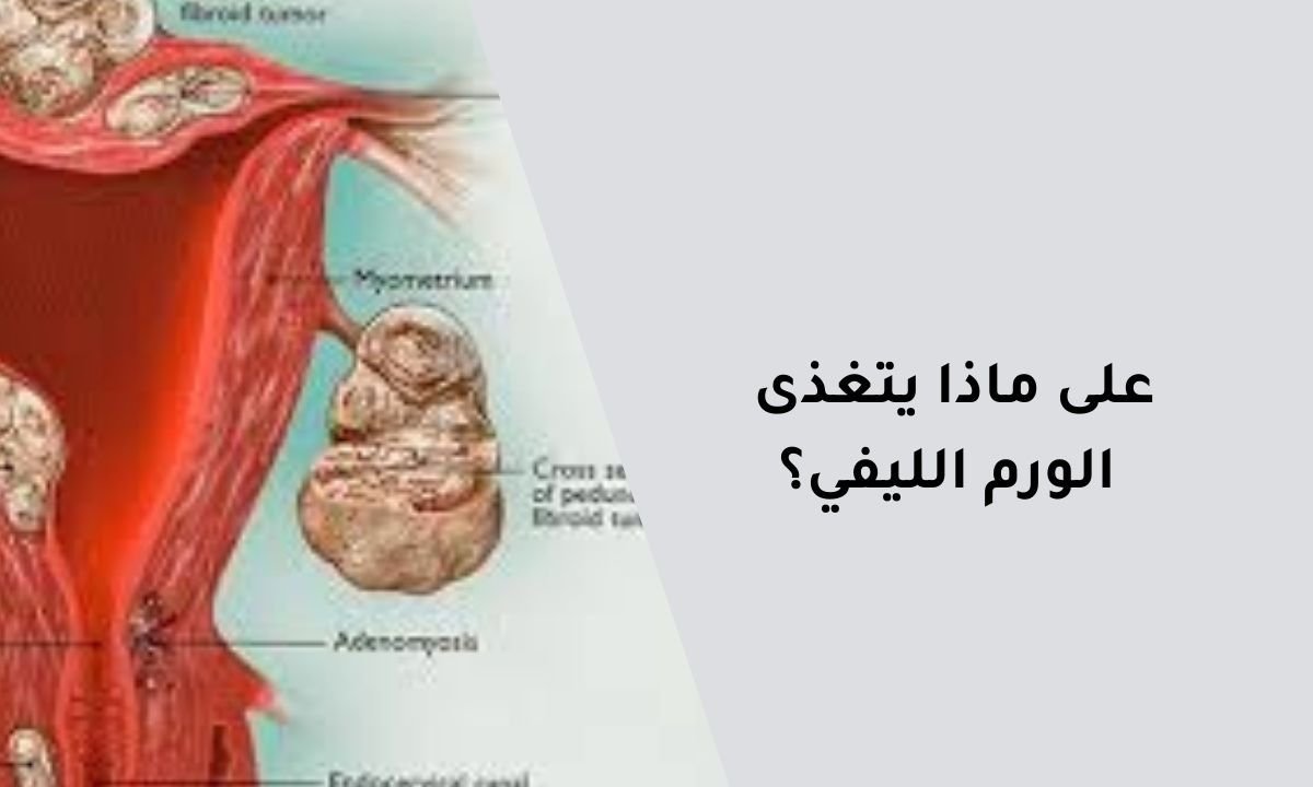 على ماذا يتغذى الورم الليفي